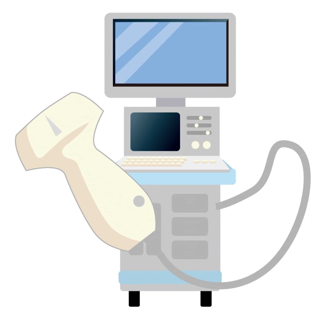 超音波診断装置